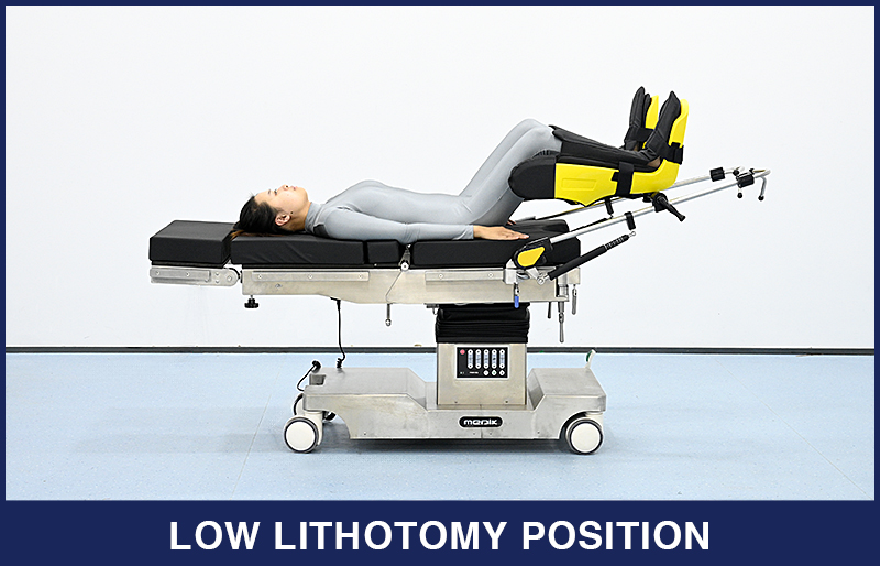 The Introduction of Lithotomy Position