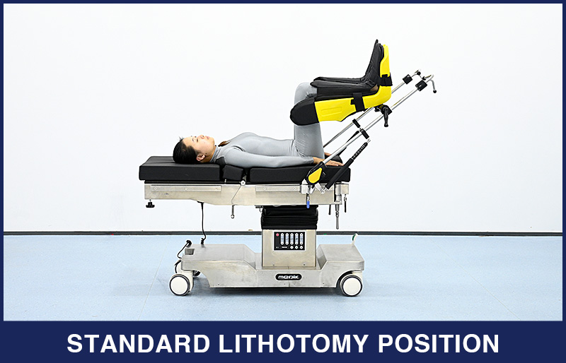 The Introduction of Lithotomy Position